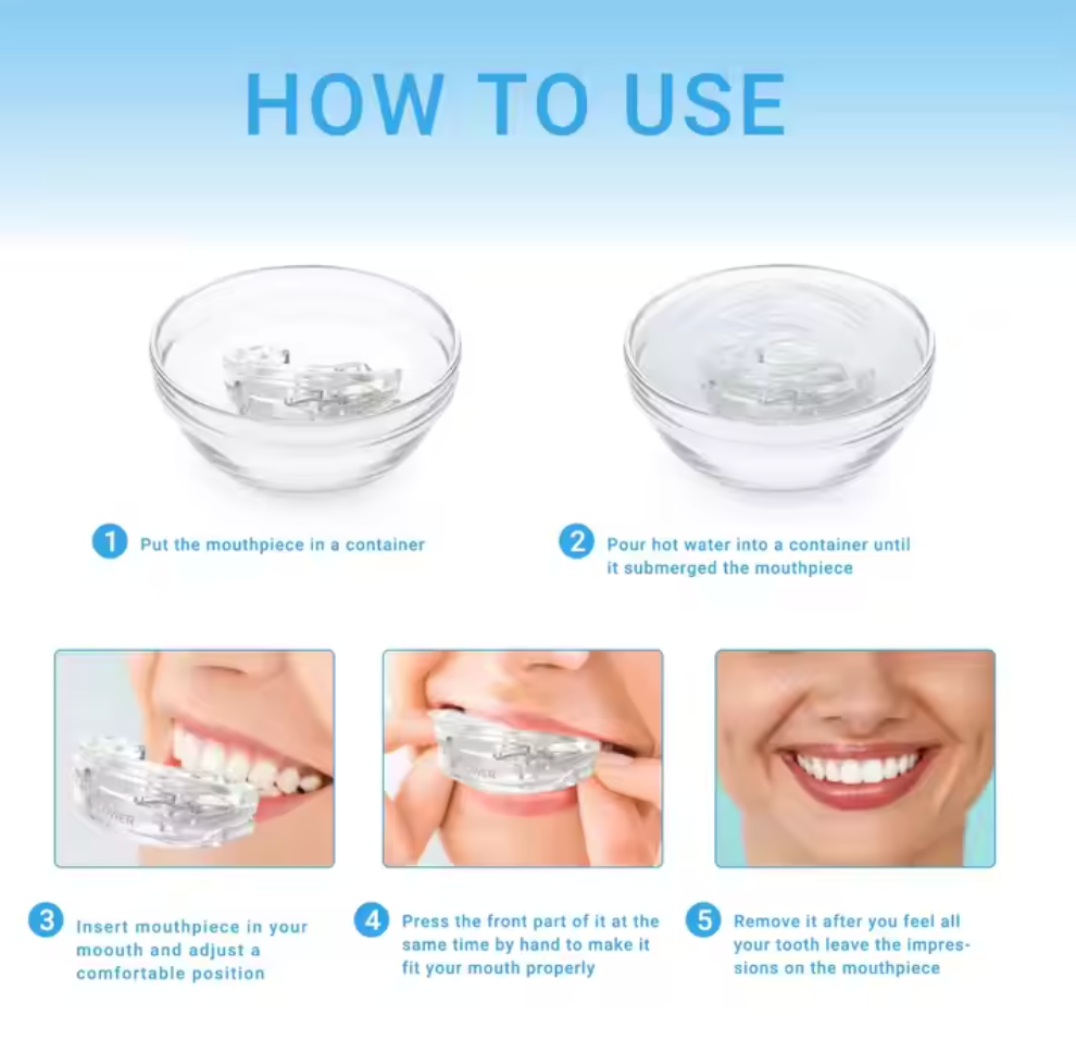 SleepDeep™ Anti-Snoring Mouthguard