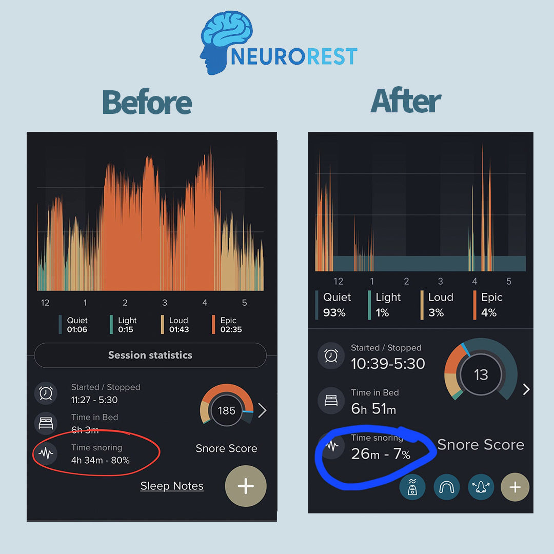 NeuroRest Listicle – Neuro Rest